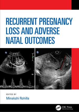 Recurrent Pregnancy Loss and Adverse Natal Outcomes de Minakshi Rohilla