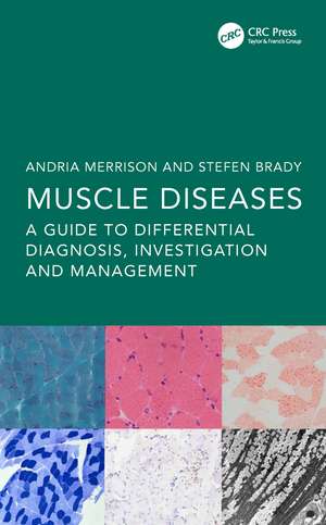 Muscle Diseases: A Guide to Differential Diagnosis, Investigation and Management de Andria Merrison