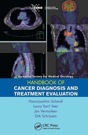 ESMO Handbook of Cancer Diagnosis and Treatment Evaluation de Hans-Joachim Schmoll