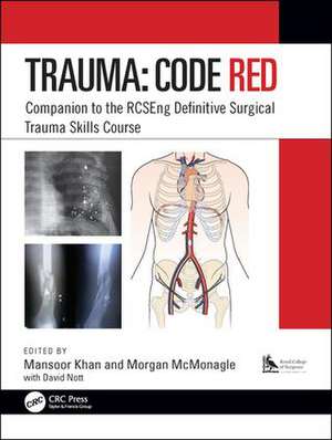 Trauma: Code Red: Companion to the RCSEng Definitive Surgical Trauma Skills Course de Mansoor Khan