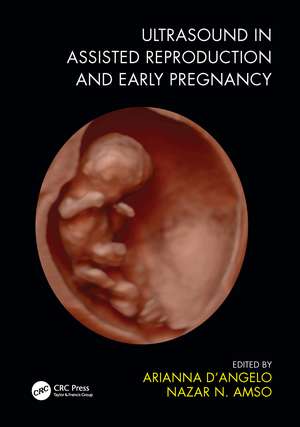 Ultrasound in Assisted Reproduction and Early Pregnancy de Arianna D'Angelo