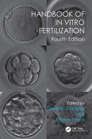 Handbook of In Vitro Fertilization de David K. Gardner