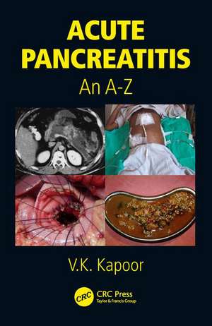 Acute Pancreatitis: An A-Z de V.K. Kapoor