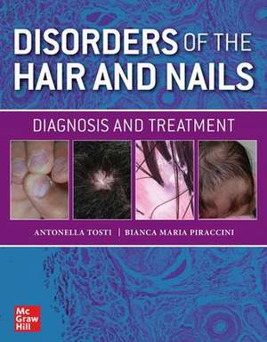 Disorders of the Hair and Nail: Diagnosis and Treatment de Antonella Tosti