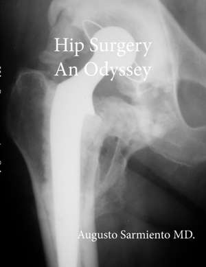 Hip Surgery - An Odyssey de Augusto Sarmiento