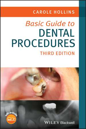 Basic Guide to Dental Procedures de Carole Hollins