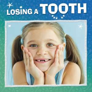 Losing a Tooth de Nicole A. Mansfield