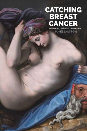 Catching Breast Cancer de James Lawson