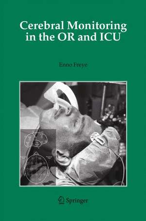 Cerebral Monitoring in the OR and ICU de Enno Freye