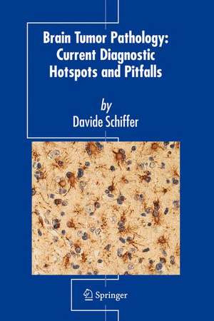 Brain Tumor Pathology de Davide Schiffer