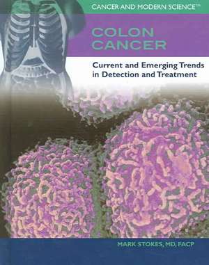 Colon Cancer: Current and Emerging Trends in Detection and Treatment de Mark Stokes