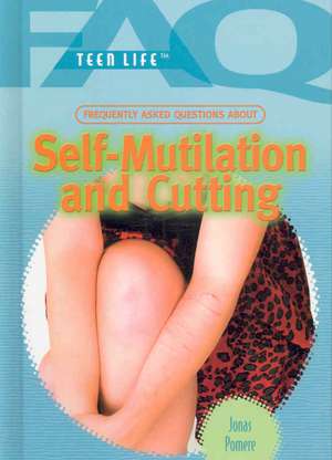 Frequently Asked Questions about Self Mutilation and Cutting de Jonas Pomere