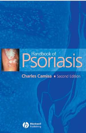 Handbook of Psoriasis 2e de C Camisa