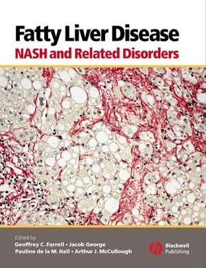 Fatty Liver Disease – NASH and Related Disorders de G. Farrell