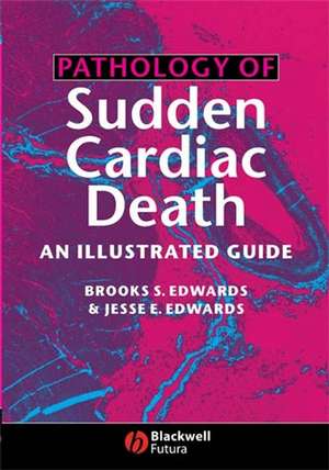 Pathology of Sudden Cardiac Death – An Illustrated Guide de BS Edwards