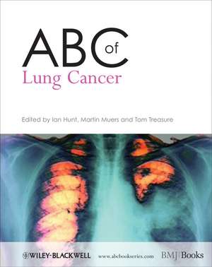 ABC of Lung Cancer de I Hunt