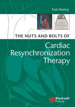 The Nuts and Bolts of Cardiac Resynchronization Therapy de T Kenny