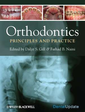 Orthodontics – Principles and Practice de DS Gill