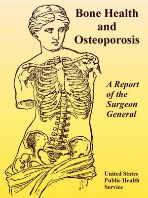 Bone Health and Osteoporosis: A Report of the Surgeon General de United States Public Health Service