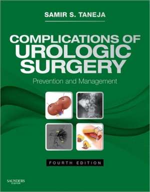 Complications of Urologic Surgery: Expert Consult - Online and Print de Samir S. Taneja