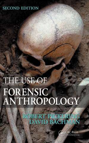 The Use of Forensic Anthropology de Robert B. Pickering