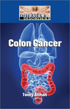 Colon Cancer de Toney Allman