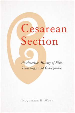 Cesarean Section de Jacqueline H Wolf