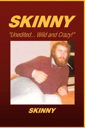 Skinny de Skinny