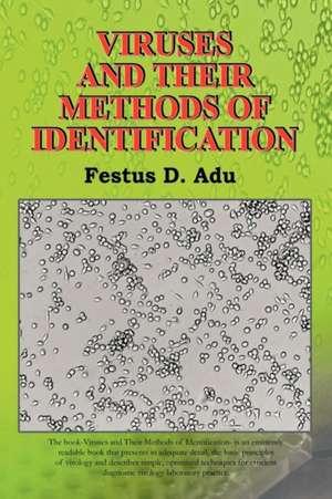 Viruses and Their Methods of Identification de Festus D. Adu