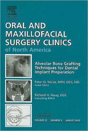 Alveolar Bone Grafting Techniques for Dental Implant Preparation, An Issue of Oral and Maxillofacial Surgery Clinics de Peter Waite