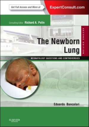 The Newborn Lung: Neonatology Questions and Controversies: Expert Consult - Online and Print de Eduardo Bancalari