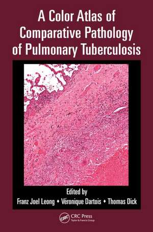 A Color Atlas of Comparative Pathology of Pulmonary Tuberculosis de Franz Joel Leong