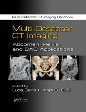 Multi-Detector CT Imaging: Abdomen, Pelvis, and CAD Applications de Luca Saba