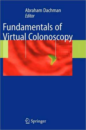 Fundamentals of Virtual Colonoscopy de Abraham H. Dachman