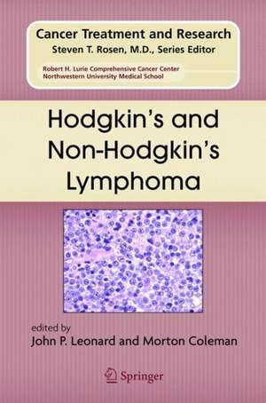 Hodgkin's and Non-Hodgkin's Lymphoma de John P. Leonard