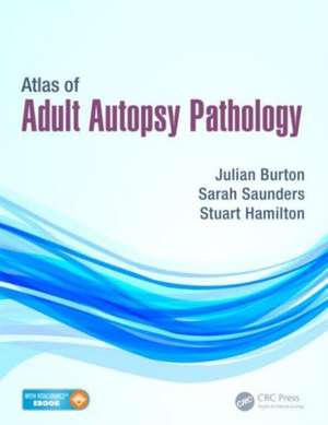 Atlas of Adult Autopsy Pathology de Julian Burton