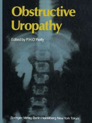 Obstructive Uropathy de Patrick H. O'Reilly