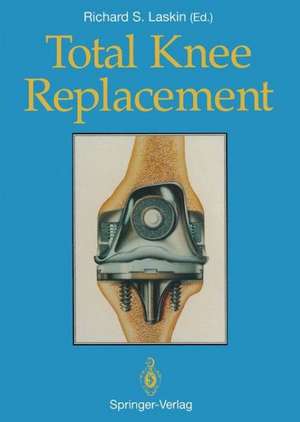 Total Knee Replacement de Barry C. Kleeman