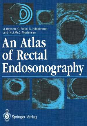 An Atlas of Rectal Endosonography de John Beynon