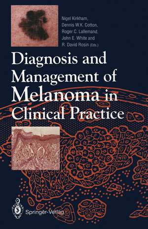 Diagnosis and Management of Melanoma in Clinical Practice de Nigel Kirkham