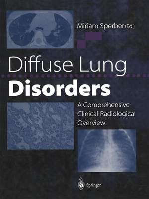 Diffuse Lung Disorders: A Comprehensive Clinical-Radiological Overview de Miriam Sperber