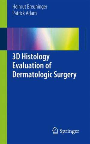 3D Histology Evaluation of Dermatologic Surgery de Helmut Breuninger