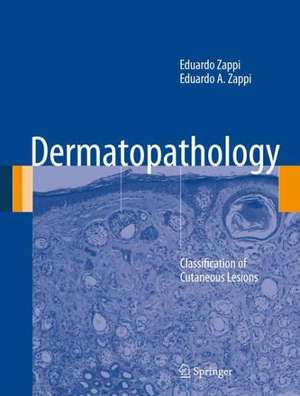 Dermatopathology: Classification of Cutaneous Lesions de Eduardo Zappi