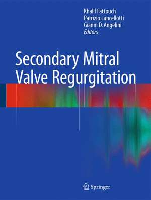 Secondary Mitral Valve Regurgitation de Khalil Fattouch