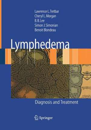 Lymphedema: Diagnosis and Treatment de Lawrence L Tretbar