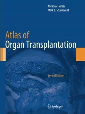 Atlas of Organ Transplantation de Abhinav Humar