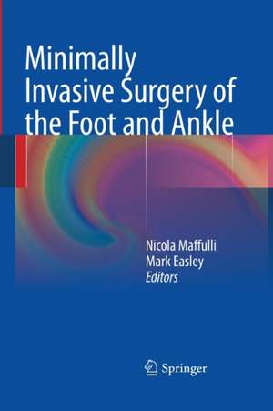 Minimally Invasive Surgery of the Foot and Ankle de Nicola Maffulli