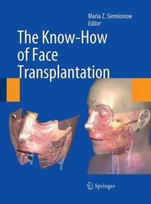 The Know-How of Face Transplantation de Maria Z. Siemionow