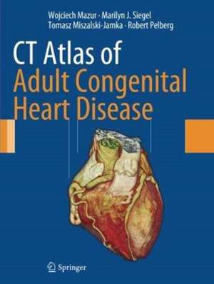 CT Atlas of Adult Congenital Heart Disease de Wojciech Mazur