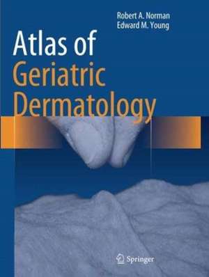 Atlas of Geriatric Dermatology de Robert A. Norman